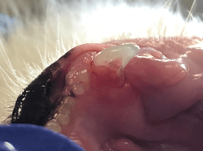 Cervical Line Lesion close up